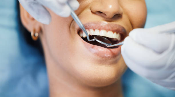 Best Emergency Dentist for Knocked-Out Tooth in South Whittier, CA